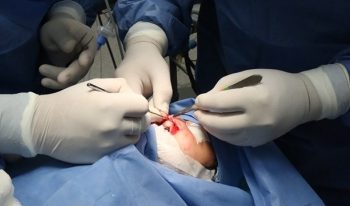 DEVOLVERÁ JORNADA QUIRÚRGICA SONRISAS A 31 MENORES CON LABIO Y PALADAR HENDIDO