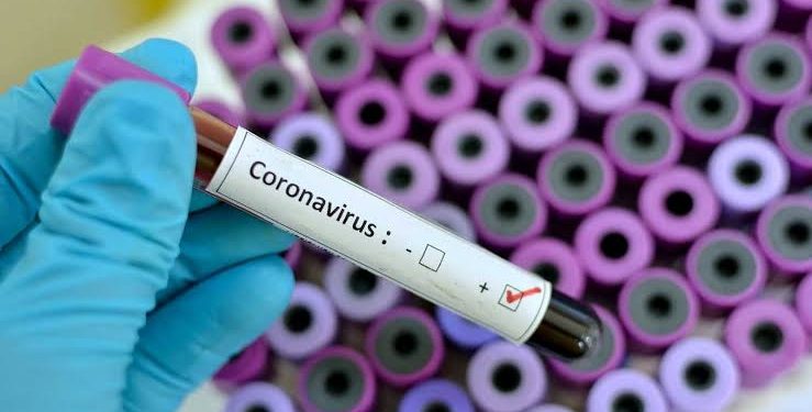 CONFIRMAN CASO DE CORONAVIRUS EN CHIAPAS