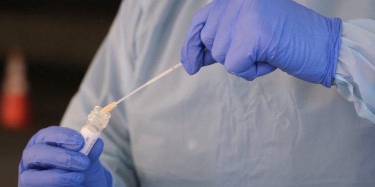 INSUFICIENTES, PRUEBAS DE COVID-19 EN MÉXICO