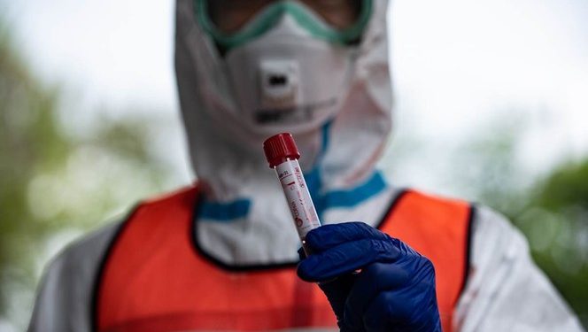 MÉXICO, EL PAÍS DE OCDE CON MENOS PRUEBAS DE CORONAVIRUS