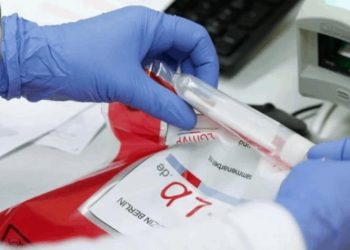 JONUTA REPORTA SU PRIMER CASO DE COVID-19