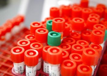 MÁS DE 400 MIL PESOS, COSTO DE ATENCIÓN POR COVID-19 EN HOSPITALES PRIVADOS