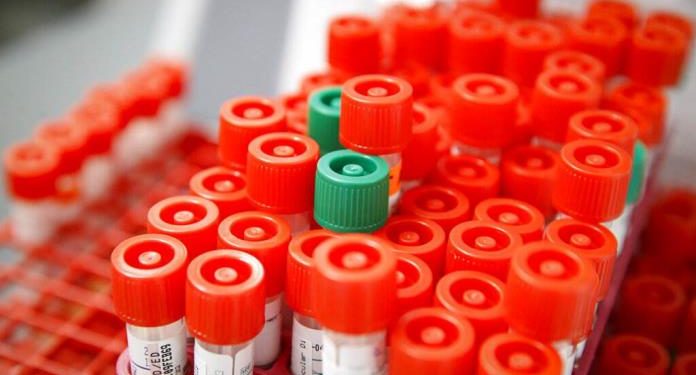 MÁS DE 400 MIL PESOS, COSTO DE ATENCIÓN POR COVID-19 EN HOSPITALES PRIVADOS