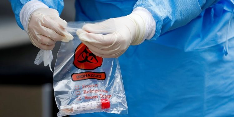 EDOMEX ACUMULA 31 MIL 75 CASOS DE COVID-19