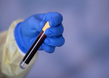 REALIZARÁ LABORATORIO DE LA UJAT PRUEBAS PARA DETECTAR COVID-19