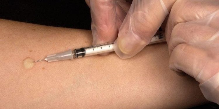 INICIARÁN EN MÉXICO PRUEBAS DE LA FASE 3 DE VACUNAS CONTRA COVID-19 SEGÚN MARCELO EBRARD