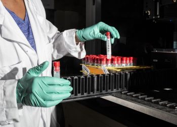 ITALIA PRODUCIRÁ PRUEBA COVID POR SALIVA QUE DA RESULTADO EN TRES MINUTOS