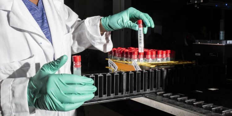 ITALIA PRODUCIRÁ PRUEBA COVID POR SALIVA QUE DA RESULTADO EN TRES MINUTOS