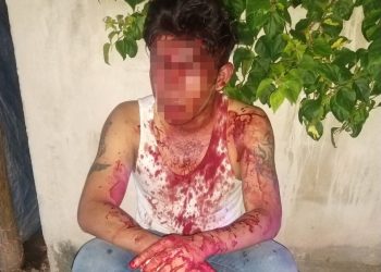 PRIVAN DE SU LIBERTAD, MANIATAN Y LESIONAN A UNA PERSONA