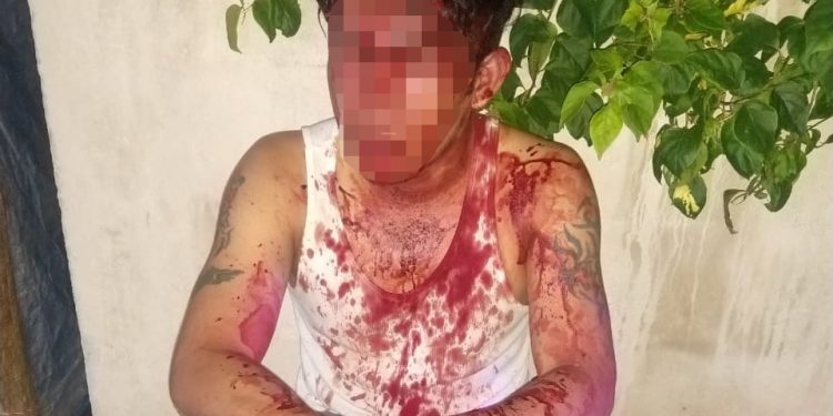 PRIVAN DE SU LIBERTAD, MANIATAN Y LESIONAN A UNA PERSONA