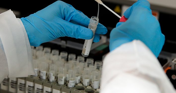 MÉXICO ROZA LOS 100.000 FALLECIDOS DE COVID-19 TRAS SUMAR 319 NUEVOS DECESOS