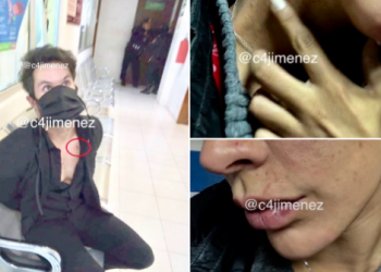 REVELAN FOTOS DE LO QUE ELEAZAR GÓMEZ LE HIZO A SU NOVIA