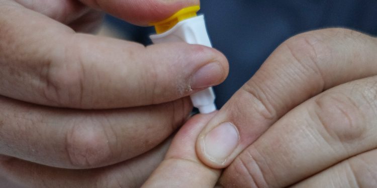 APLICARÁN PRUEBAS RÁPIDAS DE VIH SIN COSTO EN BENITO JUÁREZ