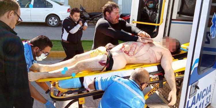 EXTRANJERO ES HERIDO CUANDO ESNORQUELEO EN COZUMEL