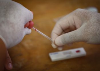 APLICA AYUNTAMIENTO DE SOLIDARIDAD 400 PRUEBAS GRATUITAS DE VIH
