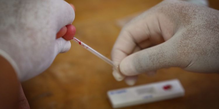 APLICA AYUNTAMIENTO DE SOLIDARIDAD 400 PRUEBAS GRATUITAS DE VIH