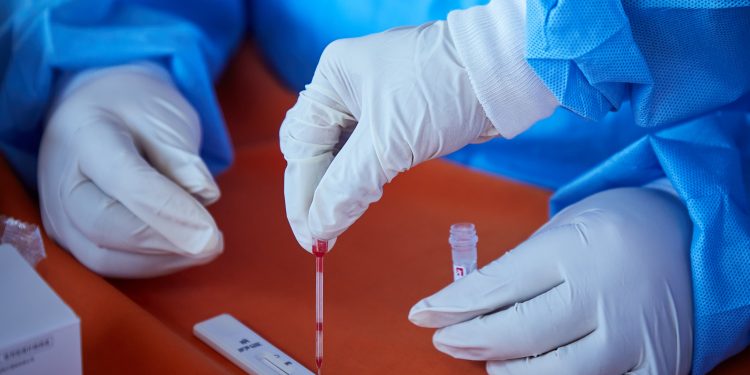 ARRANCA APLICACIÓN DE PRUEBAS RÁPIDAS PARA DETECTAR CASOS DE COVID-19