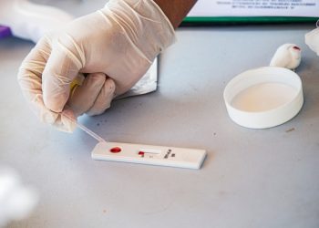 CON PRUEBAS RÁPIDAS DE DETECCIÓN DE COVID-19, SE REFUERZAN LAS MEDIDAS DE PREVENCIÓN EN TULUM