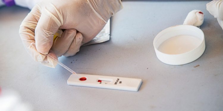 CON PRUEBAS RÁPIDAS DE DETECCIÓN DE COVID-19, SE REFUERZAN LAS MEDIDAS DE PREVENCIÓN EN TULUM