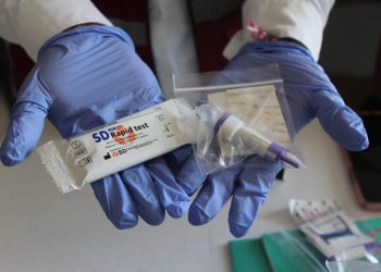 APLICARÁ LA SESA PRUEBAS RÁPIDAS DE VIH EN LA CABECERA MUNICIPAL DE FCP