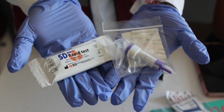 APLICARÁ LA SESA PRUEBAS RÁPIDAS DE VIH EN LA CABECERA MUNICIPAL DE FCP