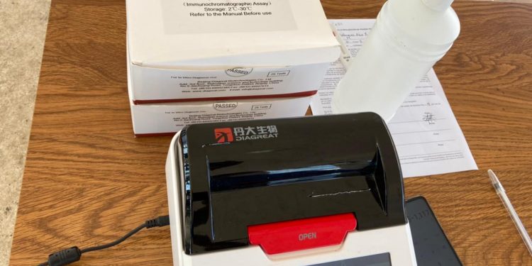 DETECTAN 5 CASOS POSITIVOS DE COVID-19 DURANTE ESTE MARTES EN FCP