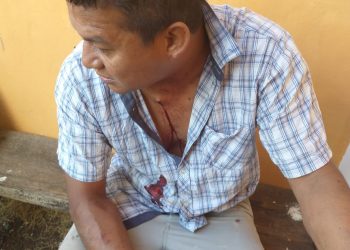 MUJER ESQUIZOFRÉNICA LESIONÓ CON UN VIDRIO A SU MARIDO Y A SU HIJO