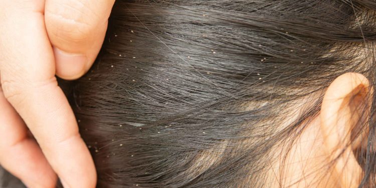 NIÑA MUERE TRAS VIVIR LLENA DE PIOJOS; PADRES PODRÍA SALIR LIBRES BAJO FIANZA