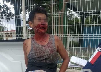 SUJETO DEJA BAÑADA EN SANGRE A SU MUJER TRAS LESIONARLA CON UN CÚTER EN CANCÚN