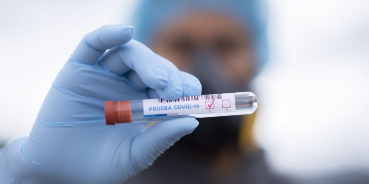 NOTIFICA SALUD 211 NUEVOS CASOS DE COVID-19 Y 9 FALLECIDOS MÁS