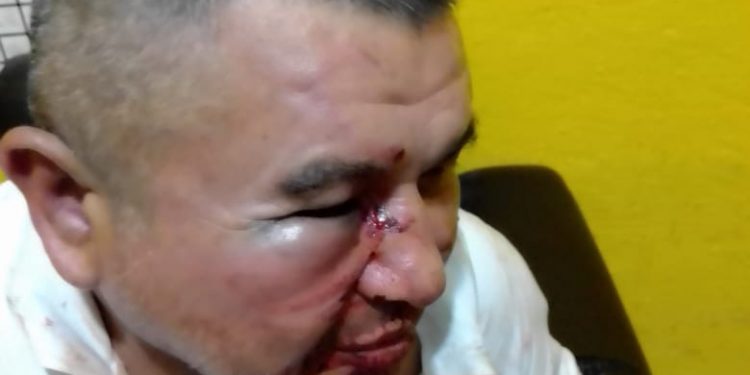 INTENTO DE LINCHAMIENTO POR TAXISTAS EN CHETUMAL