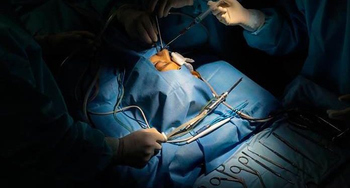 HONGO NEGRO YA EXISTÍA EN MÉXICO: EXPERTAS DE LA UNAM