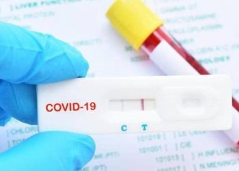 INICIA TABASCO LA SEMANA CON 2,868 PACIENTES CON CARGA VIRAL ACTIVA: SALUD