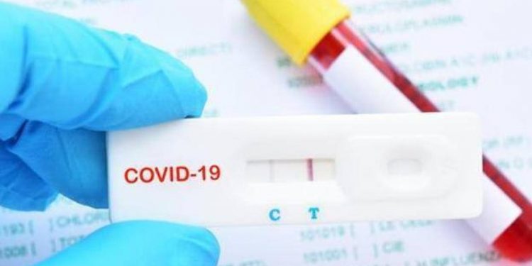 INICIA TABASCO LA SEMANA CON 2,868 PACIENTES CON CARGA VIRAL ACTIVA: SALUD