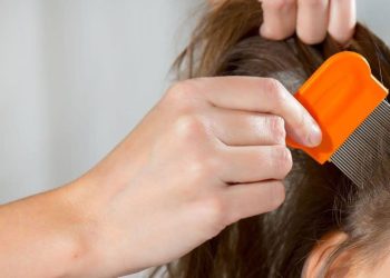 Joven muere de anemia tras contagio masivo de piojo