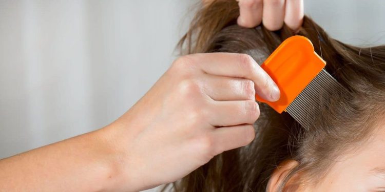 Joven muere de anemia tras contagio masivo de piojo