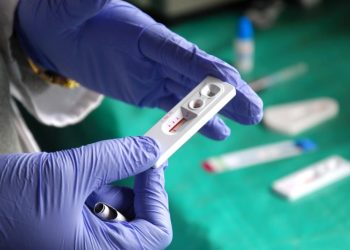 Reportan primer tratamiento eficaz del VIH en China