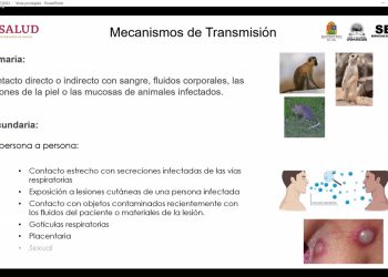 Actualiza Vigilancia Epidemiológica de SESA información sobre viruela símica