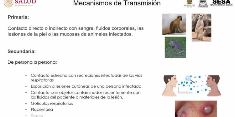 Actualiza Vigilancia Epidemiológica de SESA información sobre viruela símica