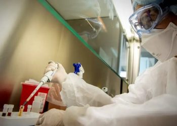 Detectan primer caso de viruela de mono en Sinaloa