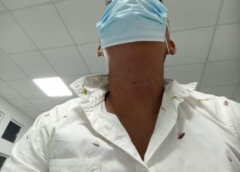 Denuncia padre brutalidad policiaca en contra de su menor hijo