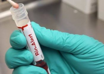 Hay probabilidad de que la viruela de mono se declaré pandemia : OMS