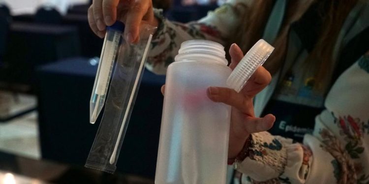 Confirman dos casos de Viruela Símica