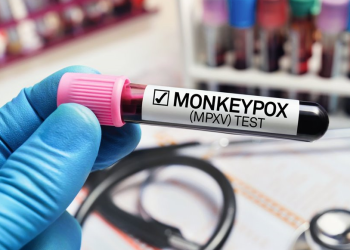 Estados Unidos declara emergencia nacional de salud por viruela del mono