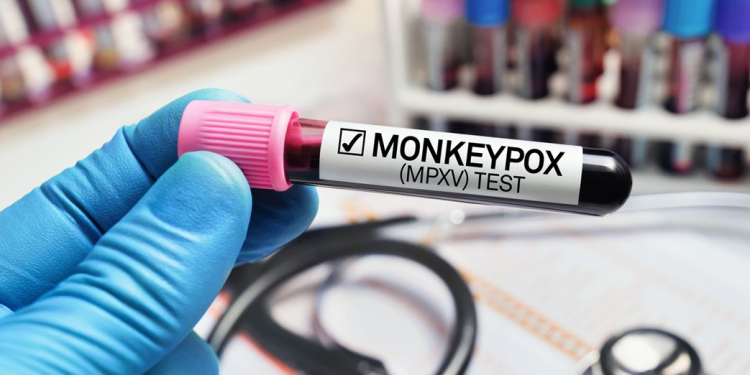 Estados Unidos declara emergencia nacional de salud por viruela del mono