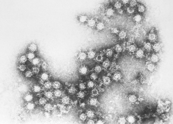 Reportan nuevos casos del virus coxsackie en Morelos