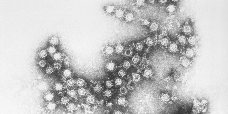 Reportan nuevos casos del virus coxsackie en Morelos