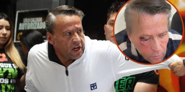 Golpean brutalmente Alfredo Adame en Tlalpan