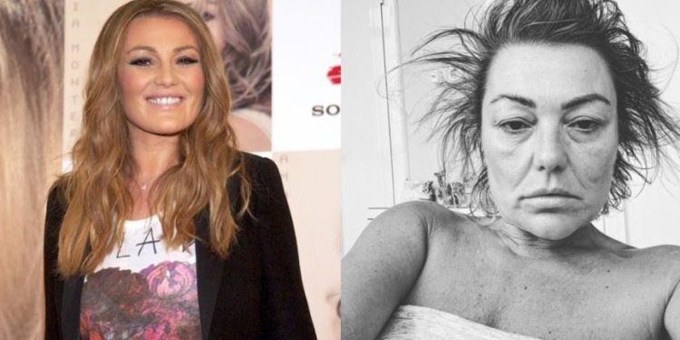 Causa preocupación Amaia Montero por su aspecto y asegura estar «destrozada»