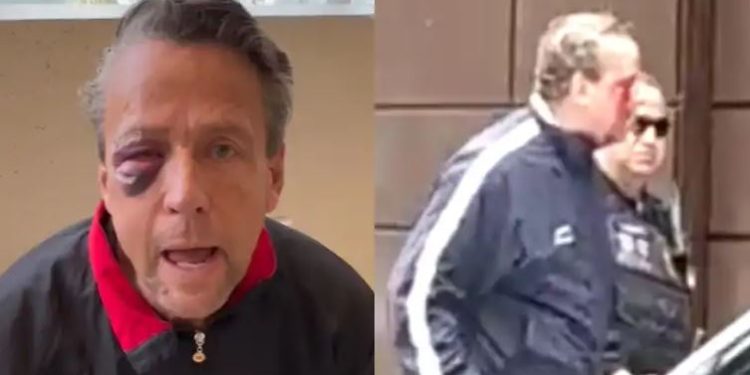 Alfredo Adame será intervenido quirúrgicamente tras la golpiza que recibió el pasado 28 de septiembre